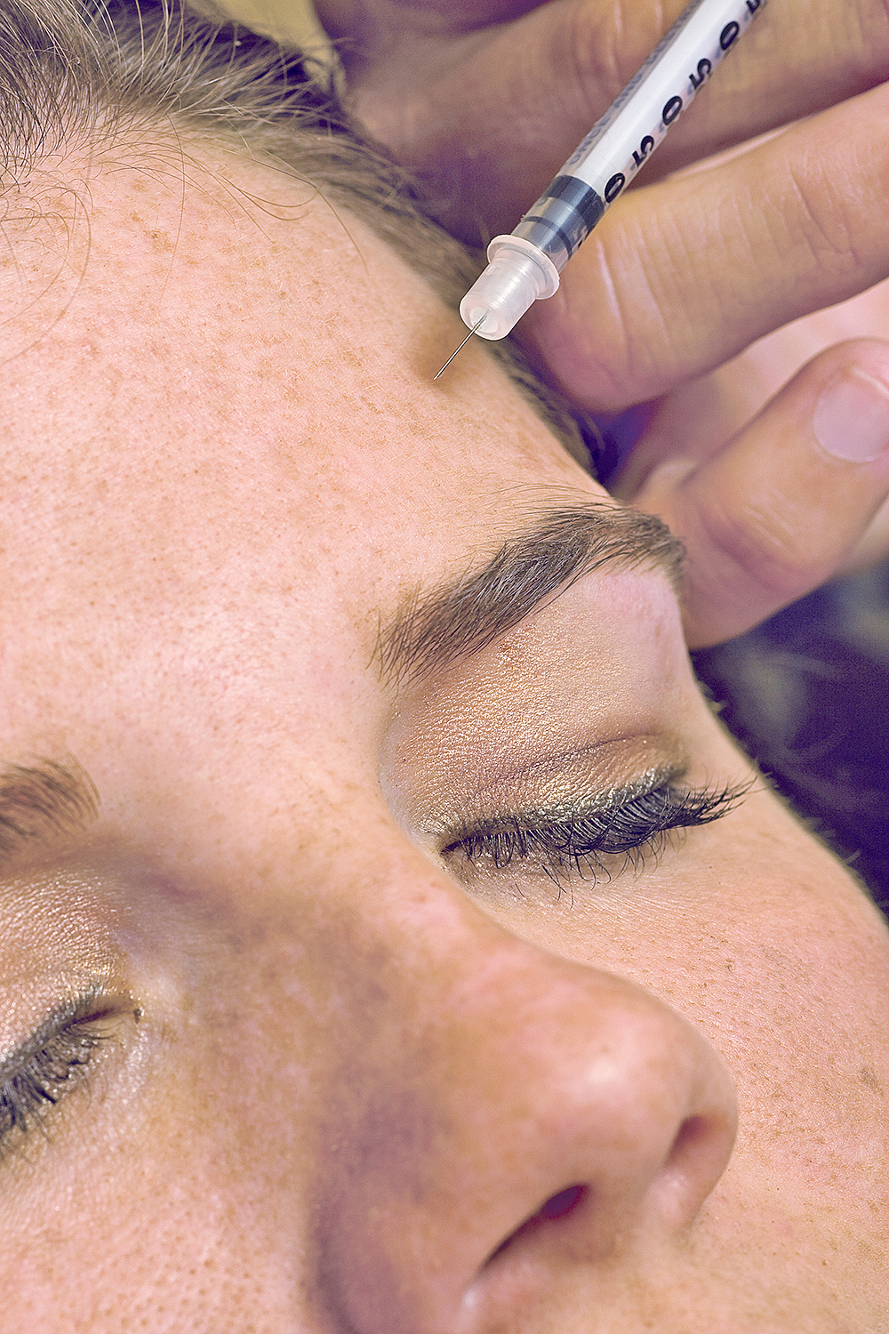 Botox, de la medicina a la estética