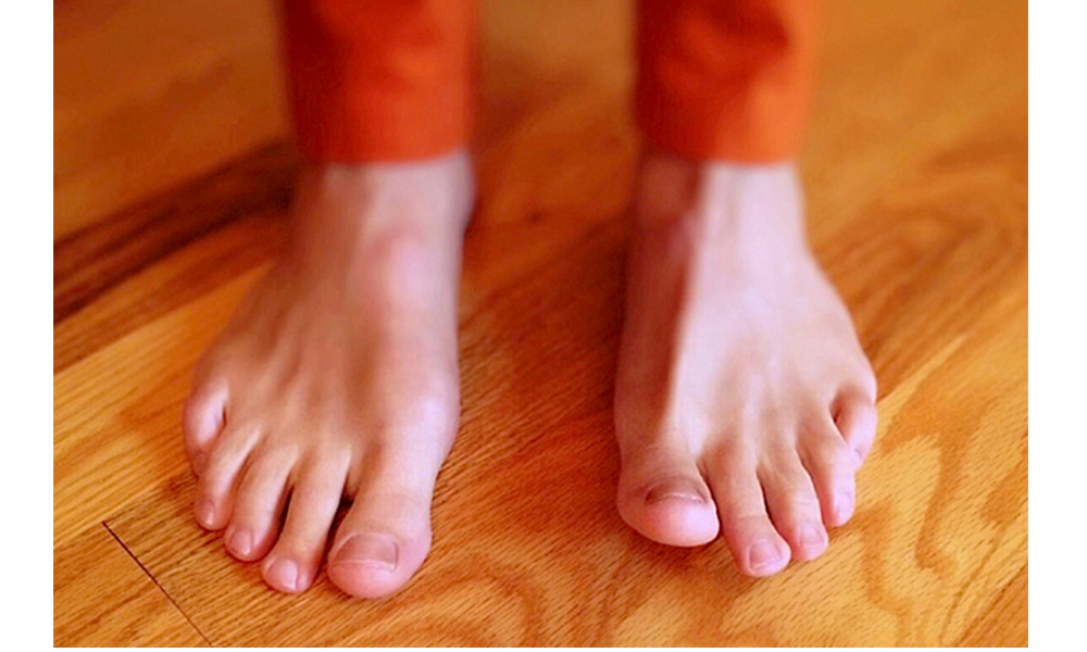 Gota, una enfermedad que afecta a tres por ciento de los mexicanos