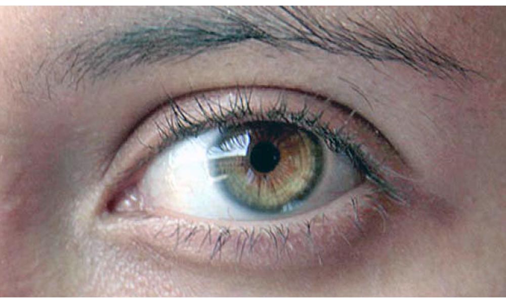 Enfermedades oculares van en aumento en países en desarrollo