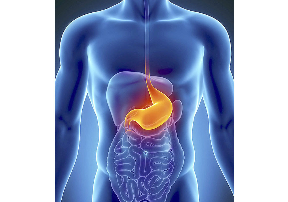 Especialista pide evitar automedicación para casos de hernia hiatal