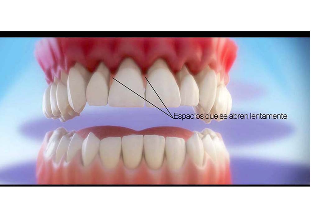 Investigación del Seguro Social relaciona periodontitis y aborto
