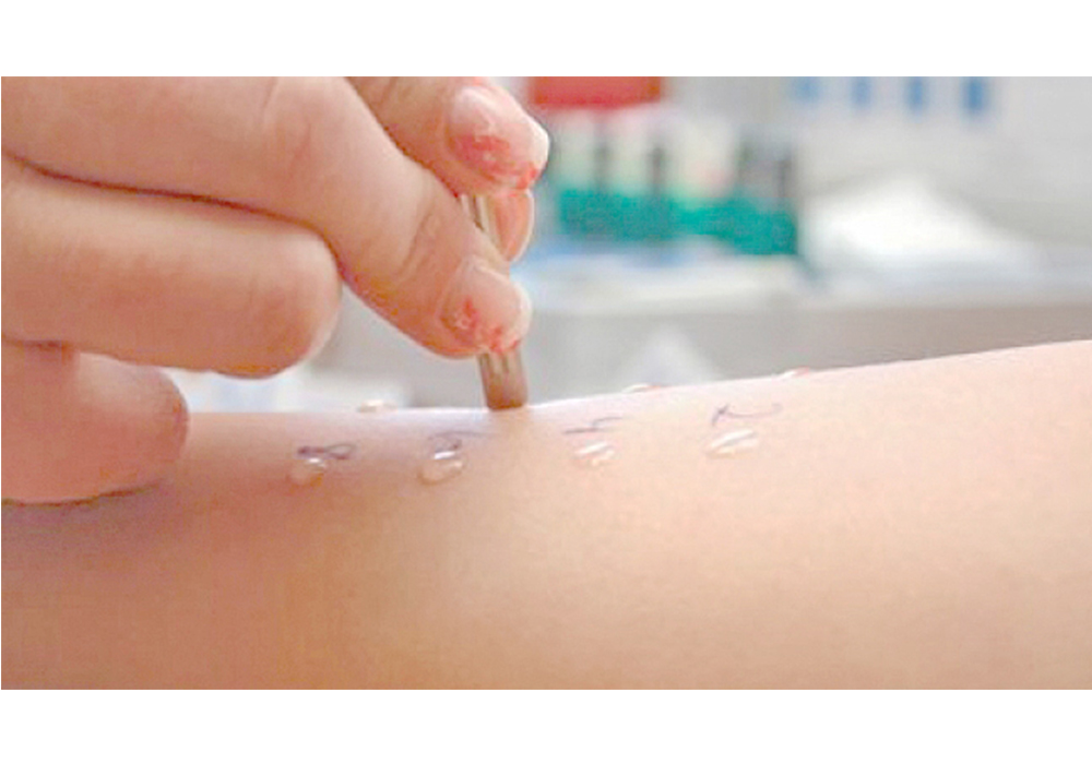 Prueba cutánea da diagnóstico preciso de asma bronquial, dice experto