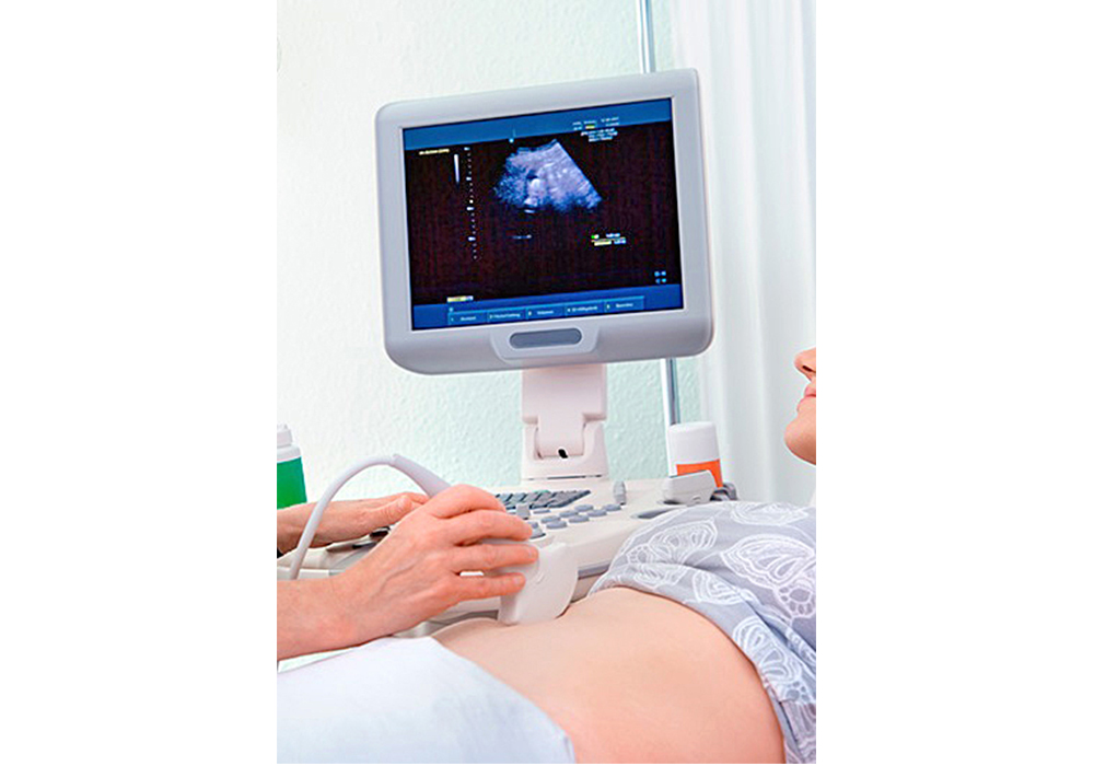 Control prenatal es fundamental para detección de Síndrome de Down