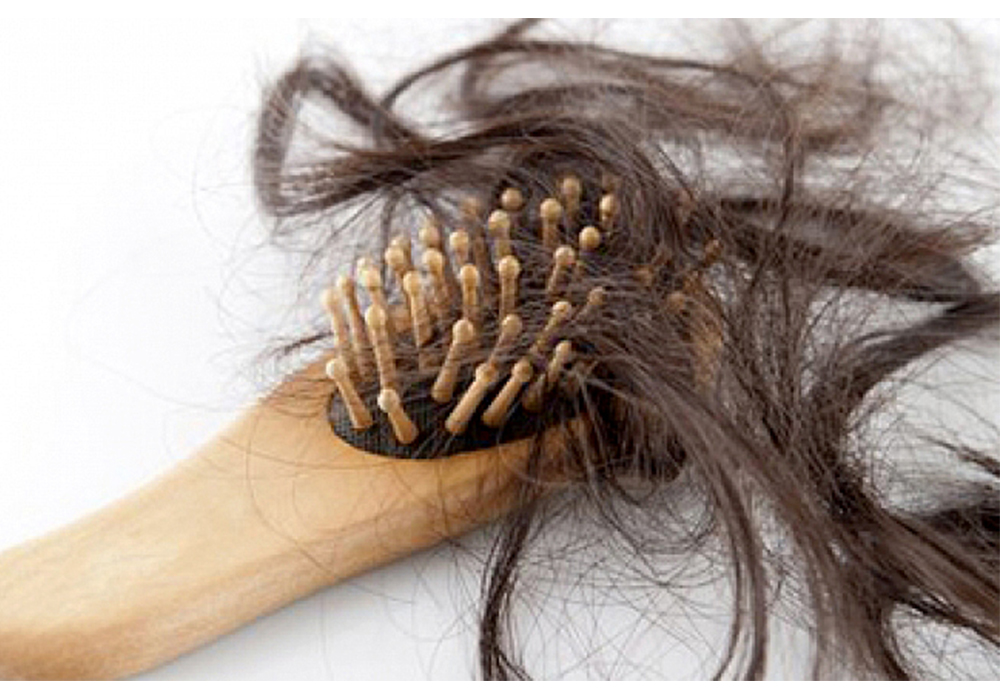 Pérdida de cabello puede ocultar alteraciones en la tiroides, alerta especialista