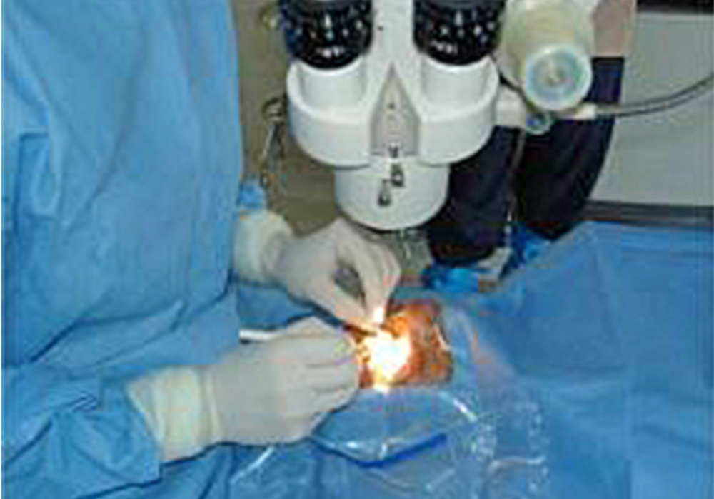 Trasplantan con éxito células iPS a paciente con enfermedad ocular en Japón