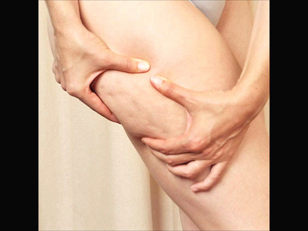 Posible revertir problemas asociados a deficiencia de colágeno: dermatóloga