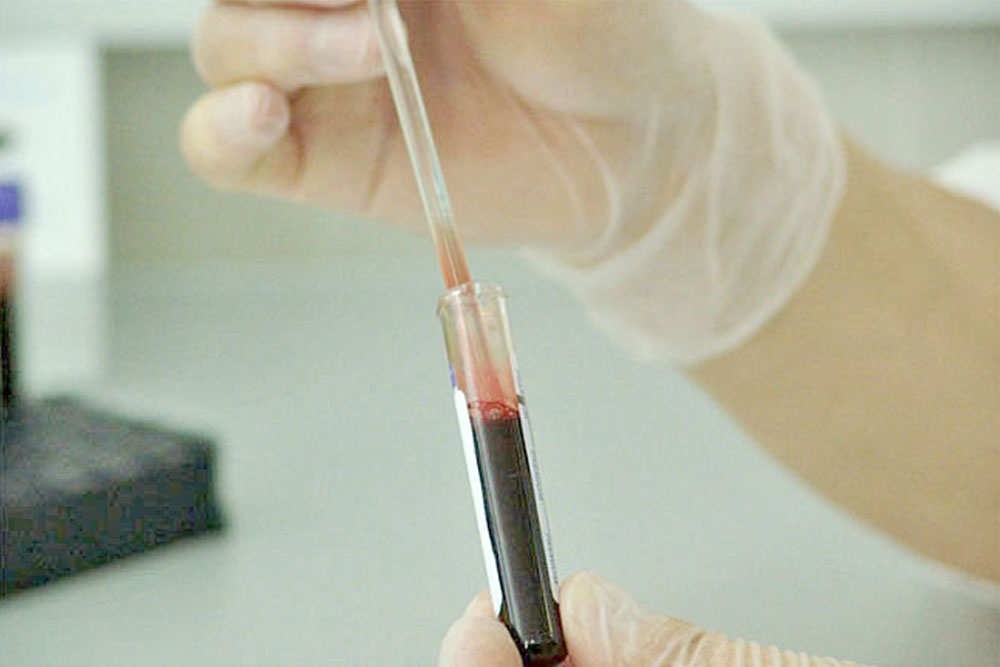 Desarrollan nanopartículas para revolucionar los análisis de sangre