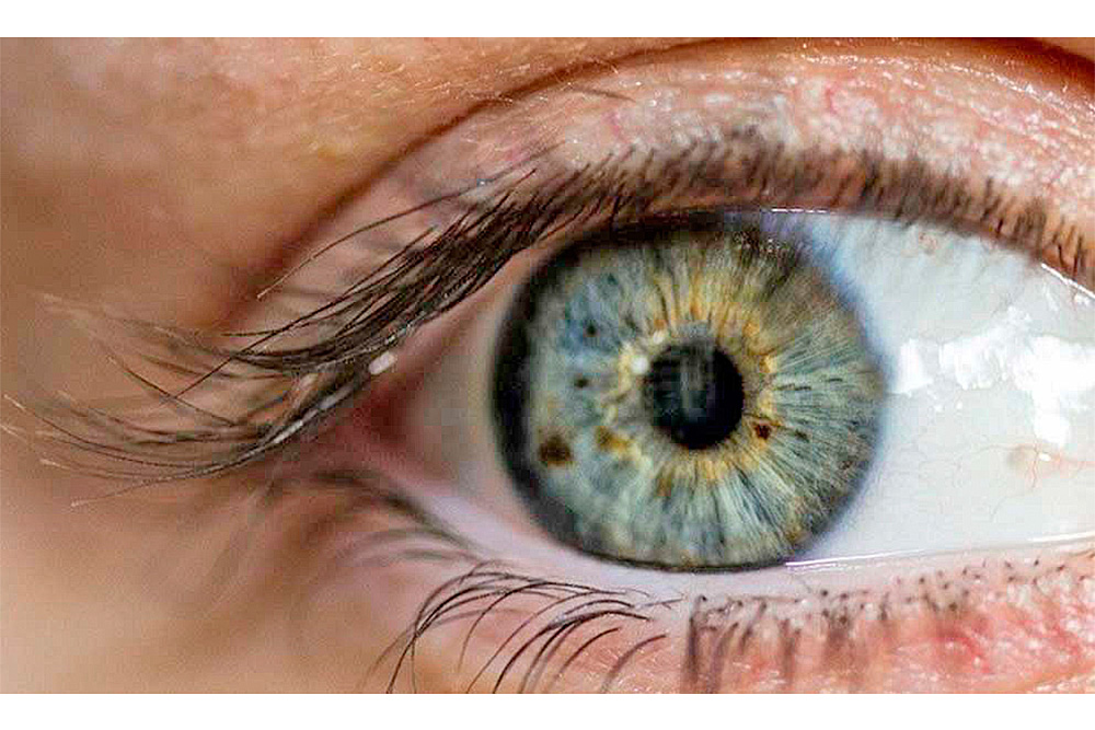 Terapia biológica salvaría de la ceguera a pacientes con uveítis