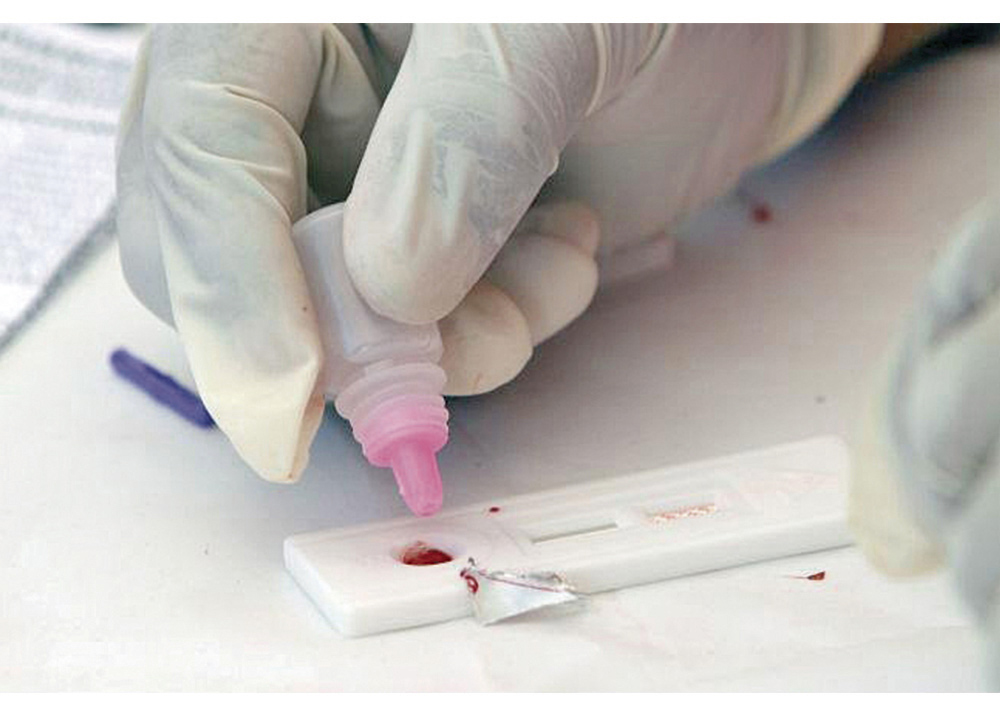 Mejora de antirretrovirales eleva esperanza de vida para pacientes con VIH