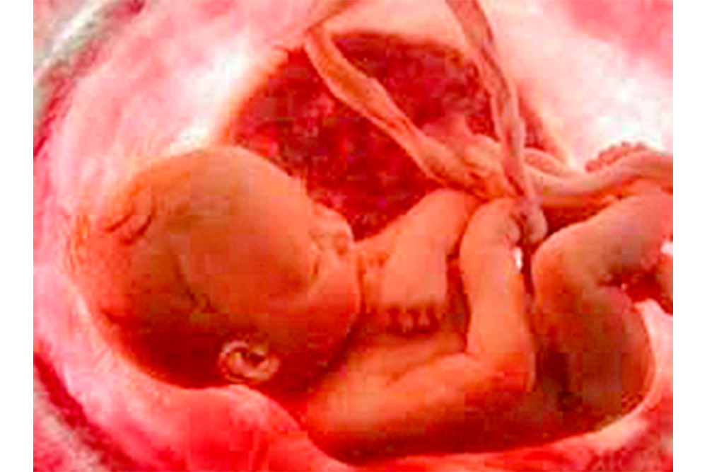 Científicos logran manipular gen peligroso en embriones humanos