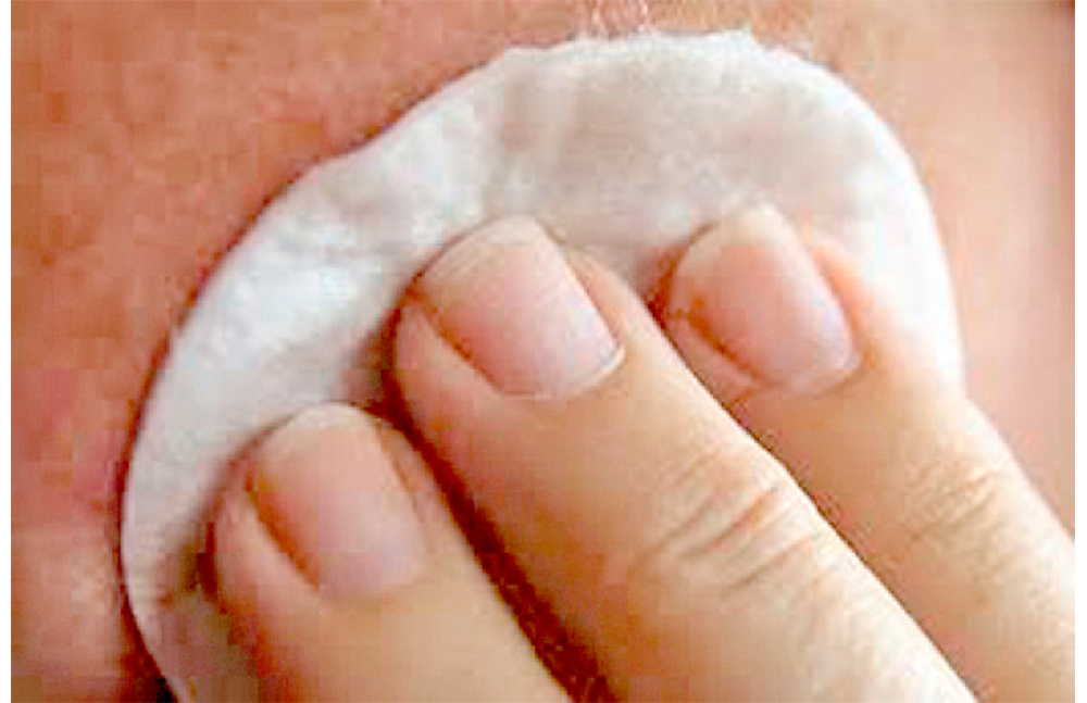 Hidradenitis supurativa daña autoestima de pacientes