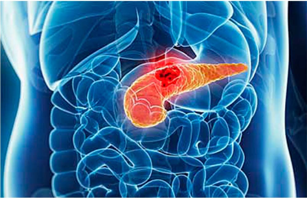 Politécnico desarrolla páncreas bioartificial para tratar diabetes