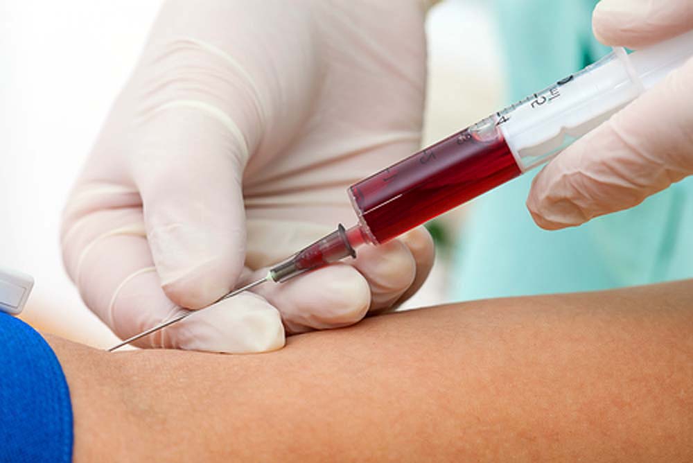 Con muestra de sangre pueden hacer detección temprana de Alzheimer