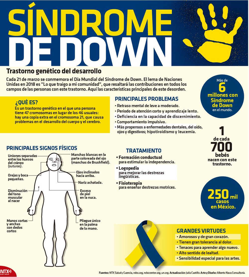 Resaltan importancia de atención médica en niños con Síndrome de Down