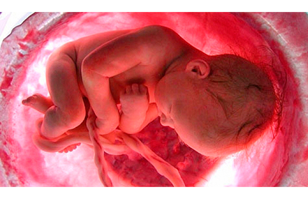 Diabetes gestacional predispone al recién nacido a la obesidad