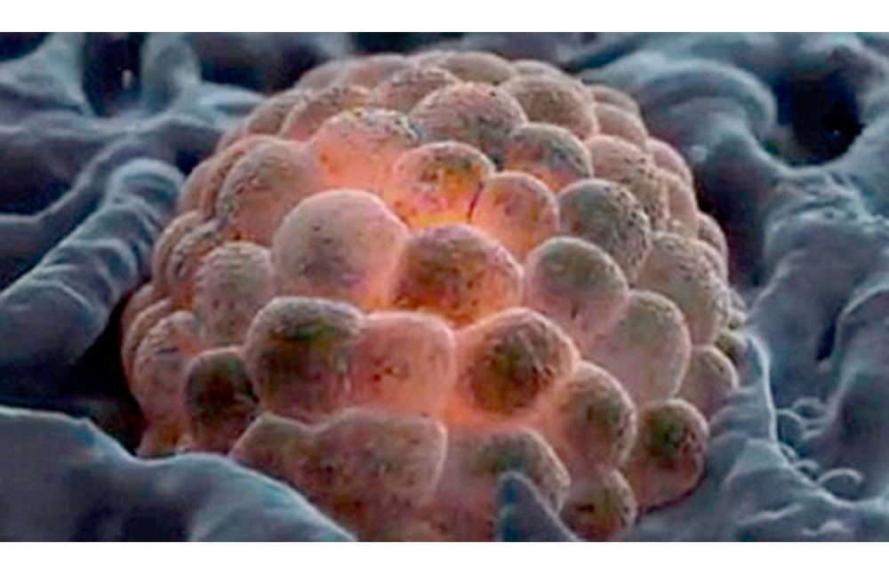 Encapsulan péptido para provocar muerte de células cancerígenas