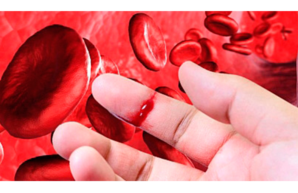 Autorizan en Europa nueva terapia para pacientes con hemofilia A grave