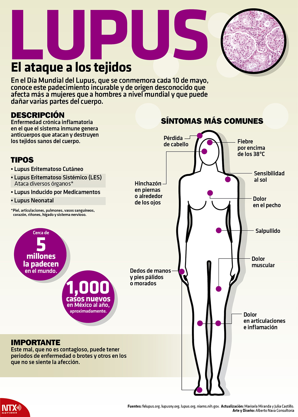 Científicos reportan nueva causa genética de lupus