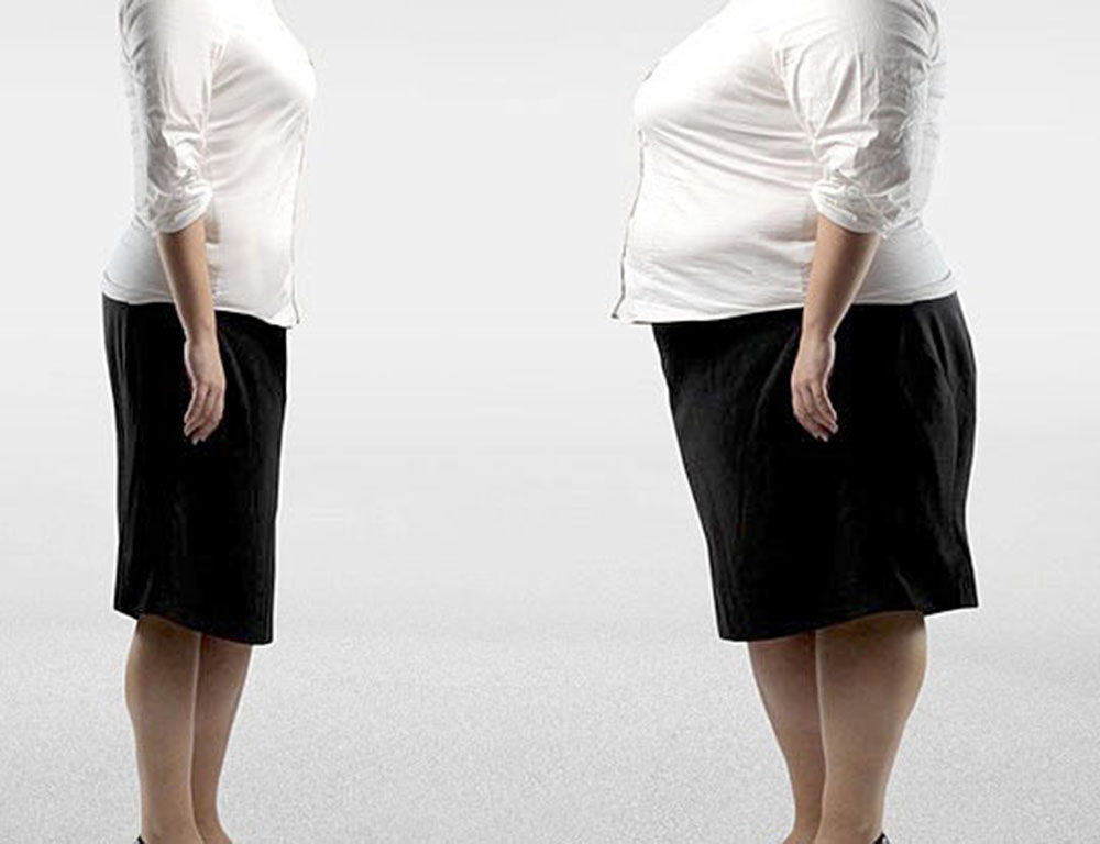 Megarexia, trastorno de la imagen corporal