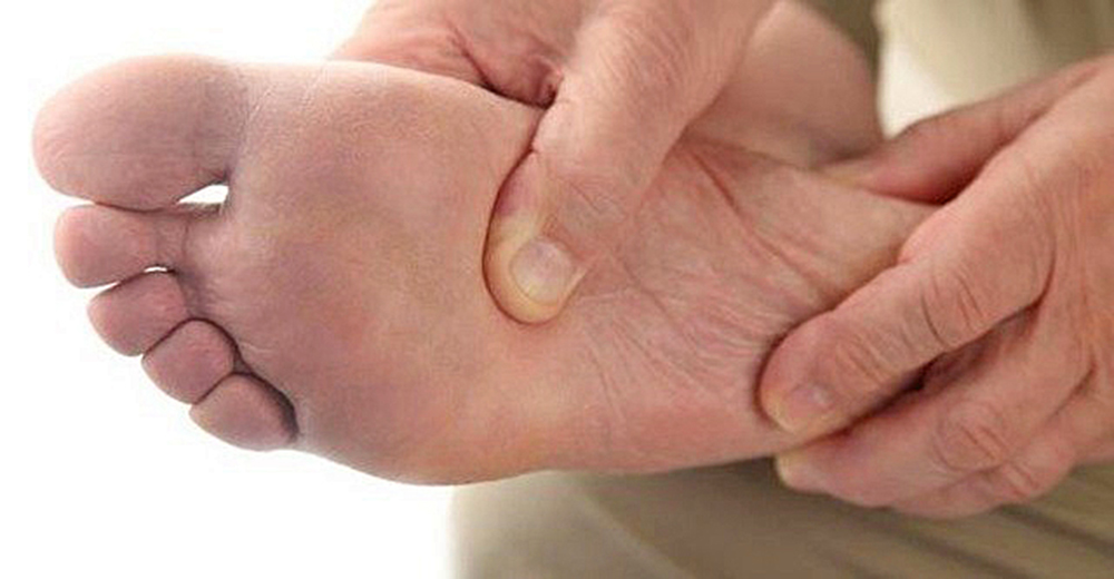 Pie diabético es evitable con control metabólico