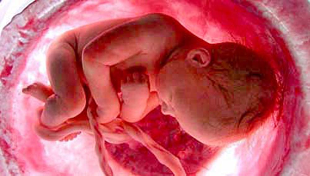 Identifican dos genes implicados en retraso de crecimiento prenatal