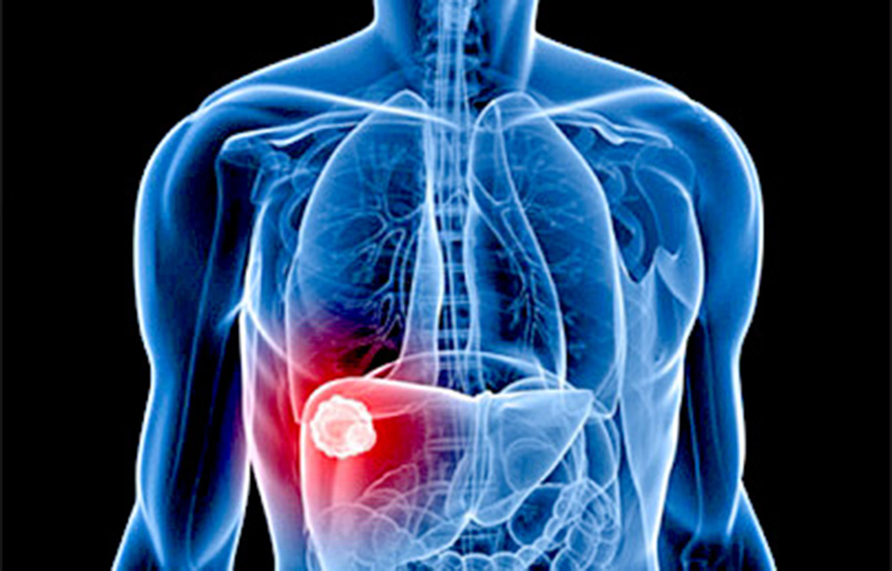 Obtienen prometedores resultados de nuevas vacunas contra hepatitis C