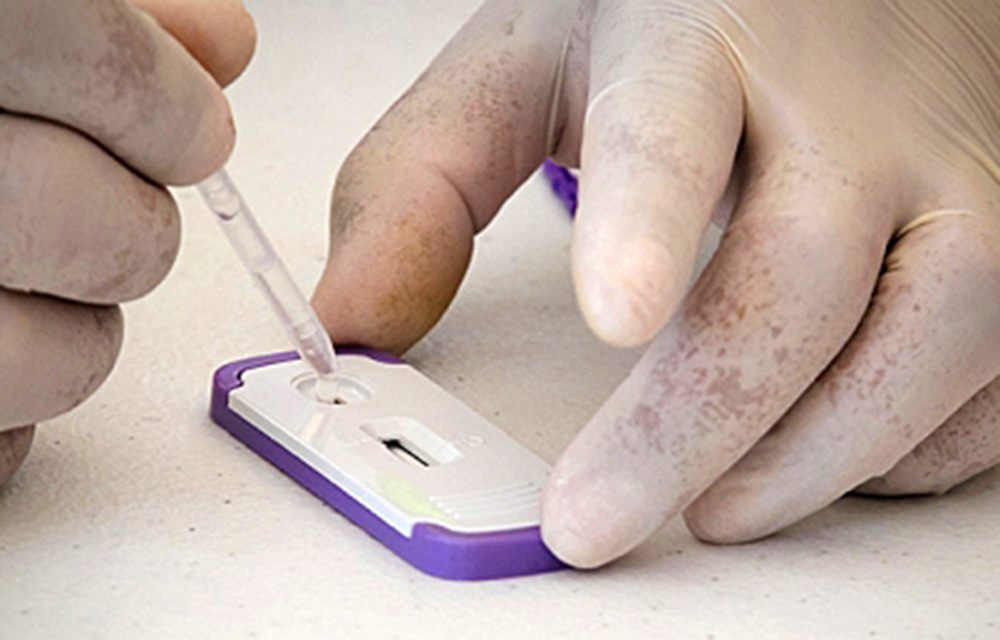 Británico suma 18 meses sin rastro de virus de inmunodeficiencia