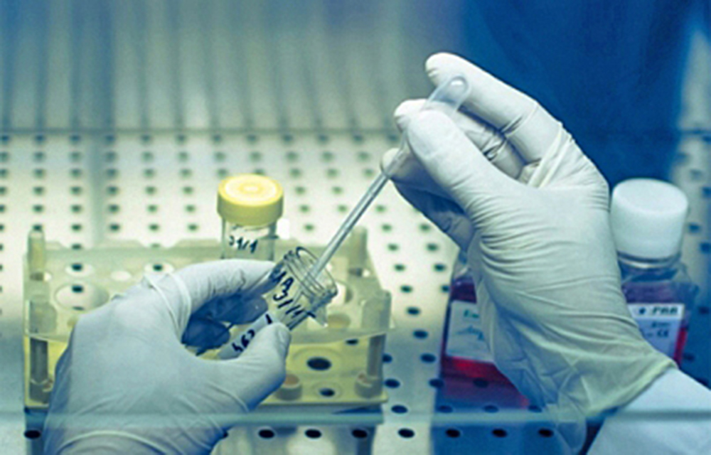 El olor de la piel podría llevar a un diagnóstico precoz de Parkinson, según estudio