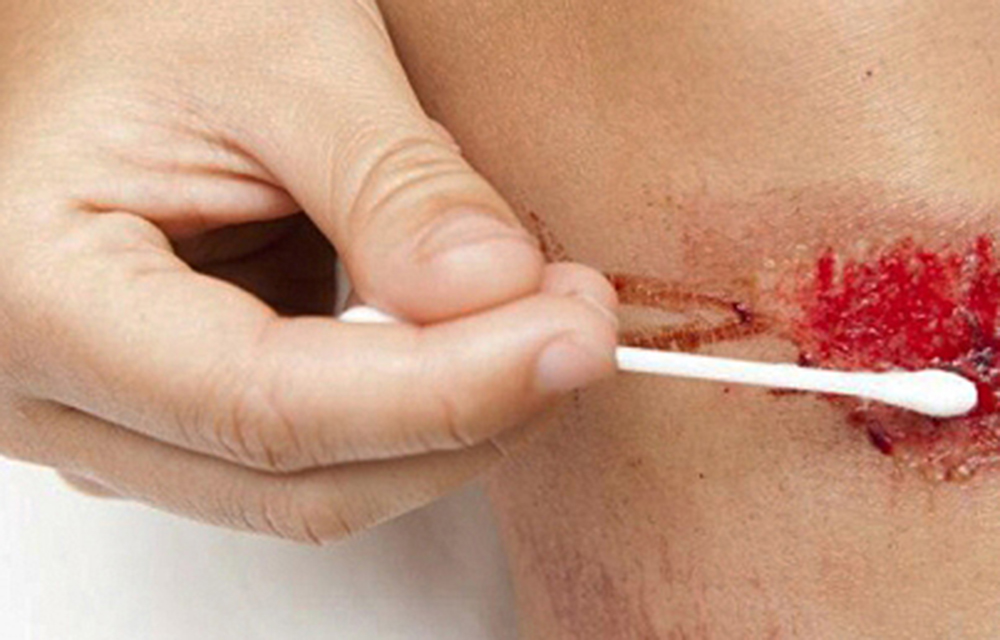 Generan biotecnología basada en células madre para curar heridas