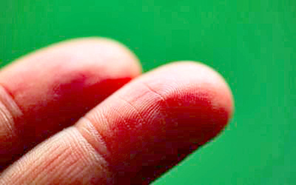 Crean catálogo de “huellas dactilares” para identificar causa de cáncer