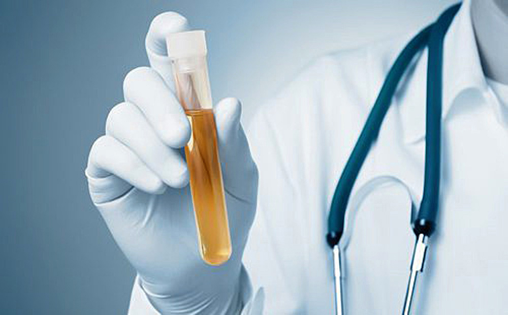 Prueba de orina podría prevenir el cáncer cervical