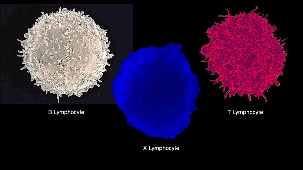Célula inmunitaria recién descubierta relacionada a Diabetes Tipo 1
