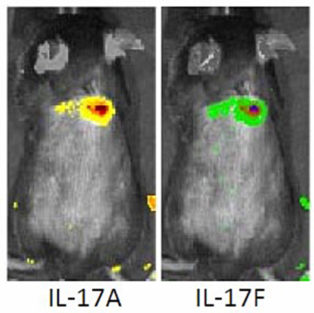 Combatiendo infecciones de estafilococo con el sistema inmunitario del cuerpo