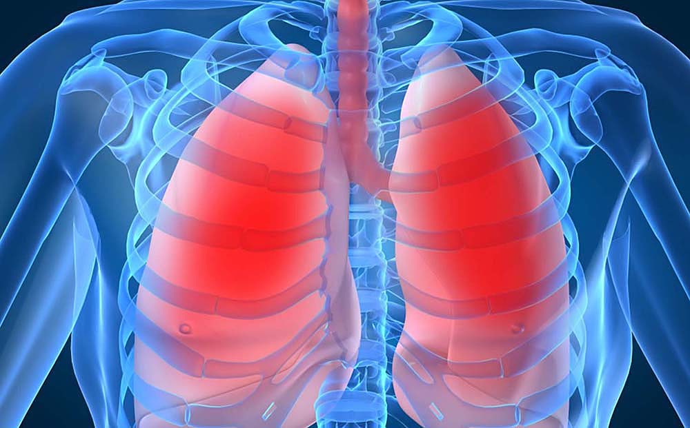 Realizan pruebas de tratamiento personalizado para fibrosis quística