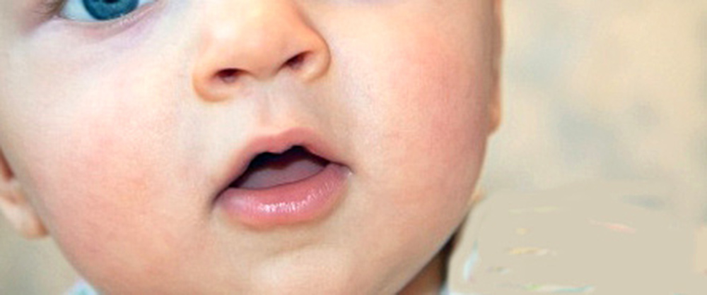 Atención dental en embarazo asegura la salud bucal de los bebés