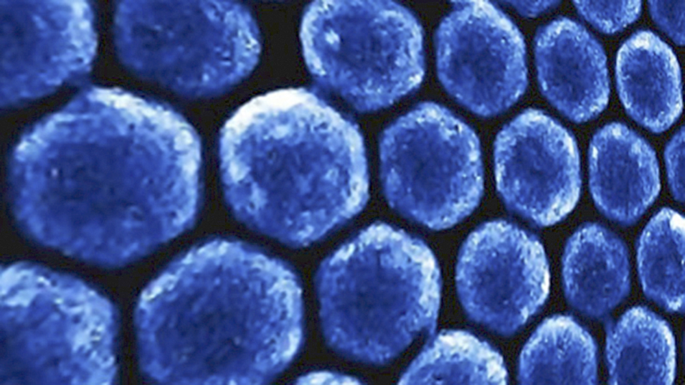 Uso de silicio favorece detección de cáncer