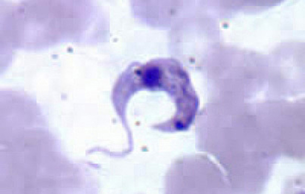 Mal de Chagas eleva riesgo de insuficiencia cardiaca