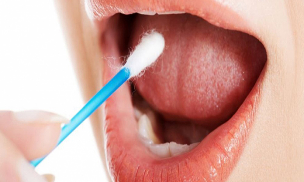 Hallan técnica para detectar cáncer de boca y garganta