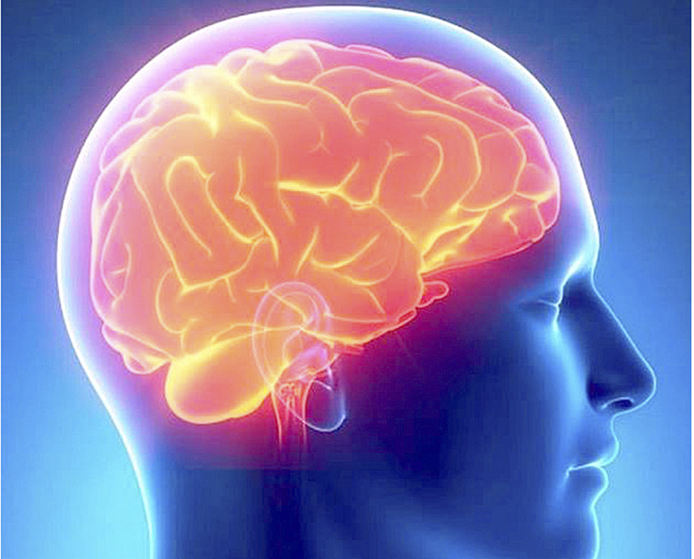 Meningitis puede dejar secuelas en el sistema nervioso central