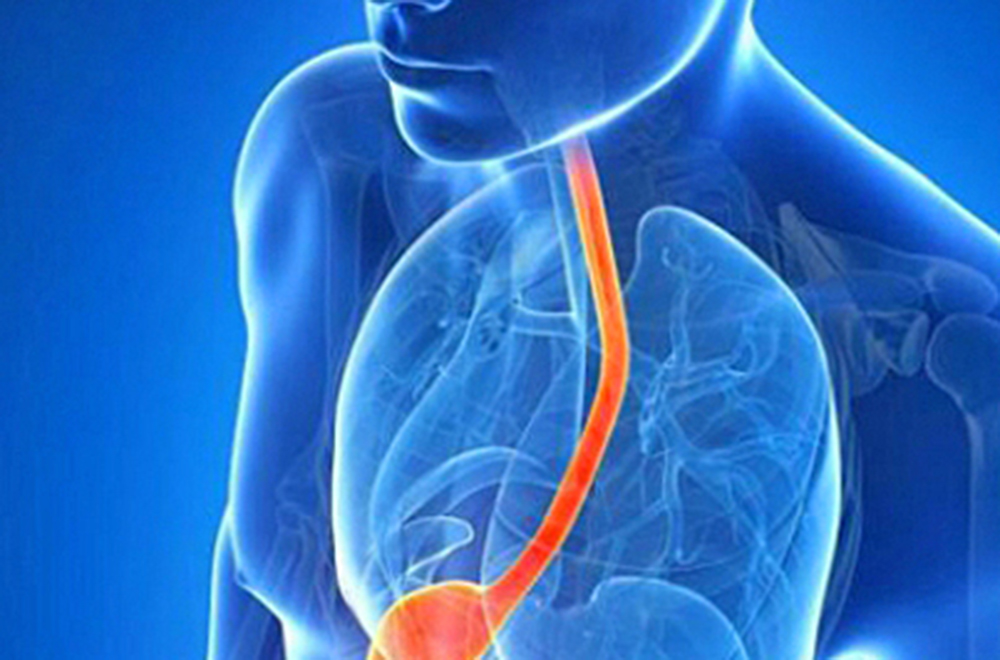 Señalan que el reflujo es nocivo porque puede provocar neumonías