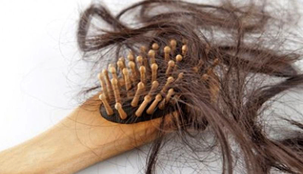 Trenzas, extensiones y tratamientos pueden causar calvicie