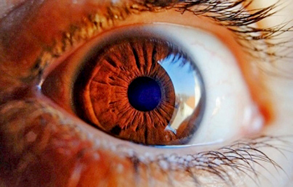 ¿Qué es la retinopatía diabética?