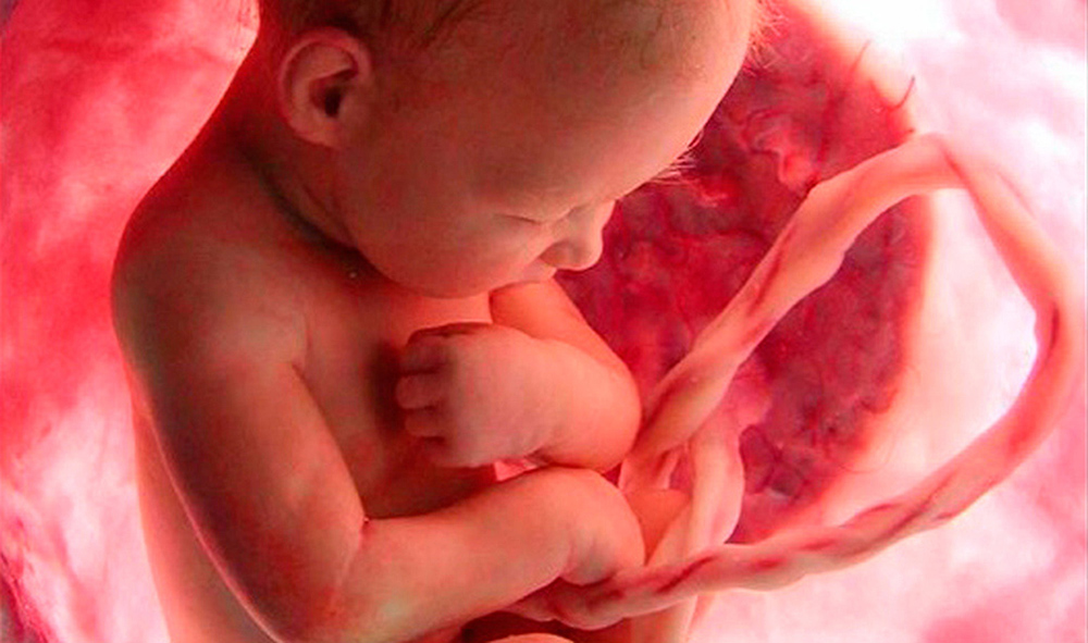 Descubren células de cordón umbilical para tratamiento de leucemia