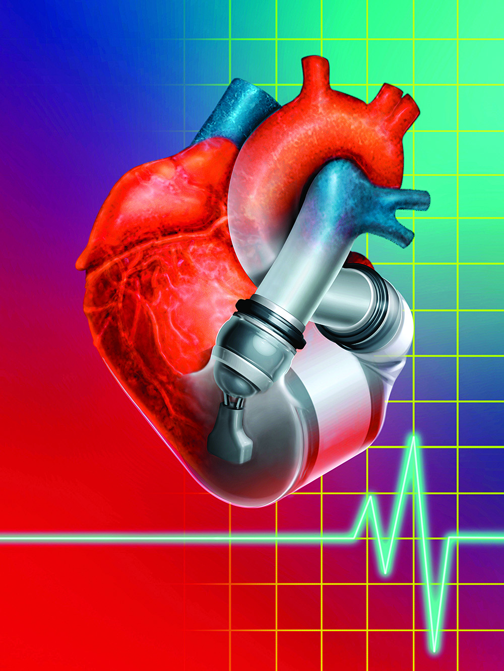 Causa y síntomas de las valvulopatías