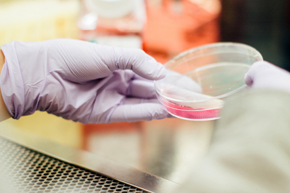 Científicos consiguen regular síntomas de ELA, enfermedad neurodegenerativa