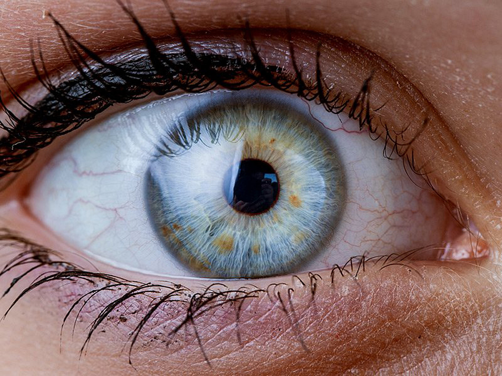 ¿Qué son los flotadores oculares y cómo dañan la visión?