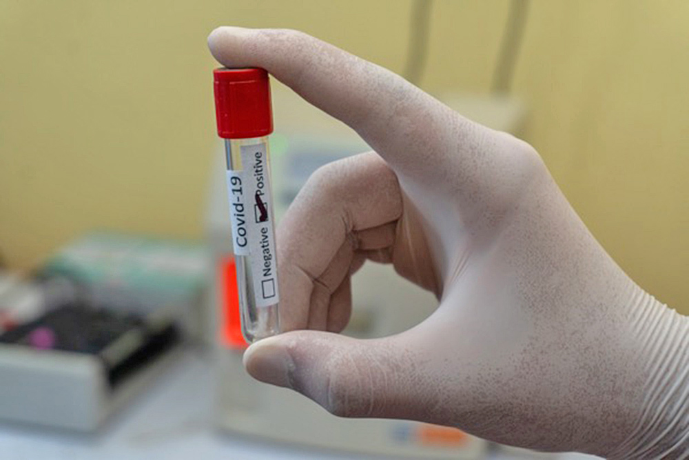 CDC reafirma necesidad de realizar pruebas Covid a asintomáticos en Estados Unidos