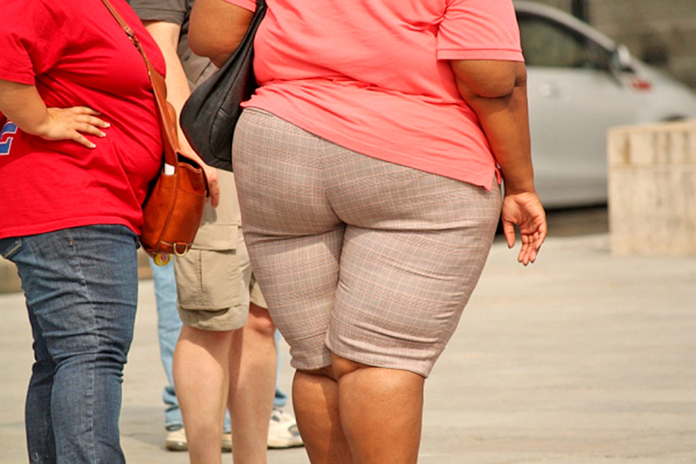 La obesidad aumenta el riesgo de hospitalización por Covid-19, confirman estudios