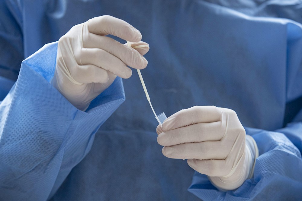 Casos globales de COVID llegan a 95,3 millones, con 2,05 millones de muertes