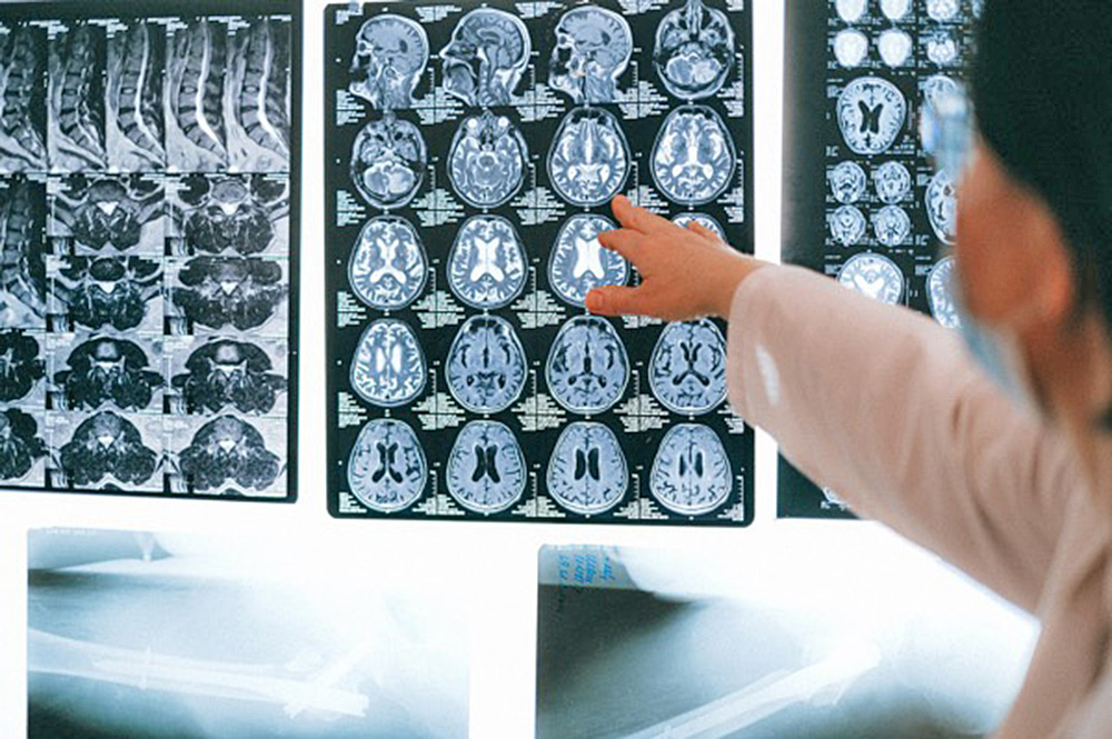 Científicos estudian el comportamiento neuronal durante actividades sociales